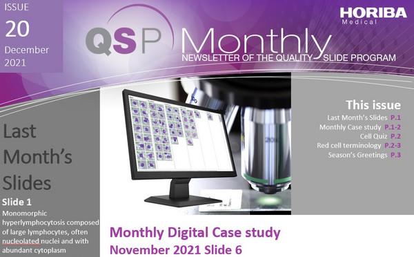 HORIBA Medical QSP Newsletter #20 - Neutro Toxic Granulation (NTG) HORIBA Medical QSP Newsletter #20 - Neutro Toxic Granulation (NTG)