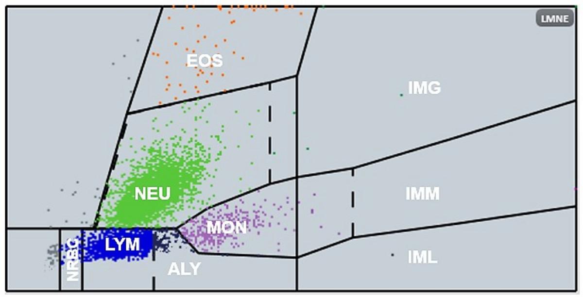 Figure 2_10 Part Differential for WBC analysis_technology_HORIBA Medical