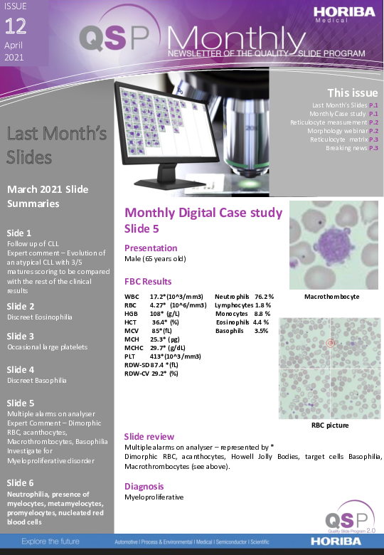 QSP Newsletter_Issue 12_April 2021_HORIBA Medical thumbnail