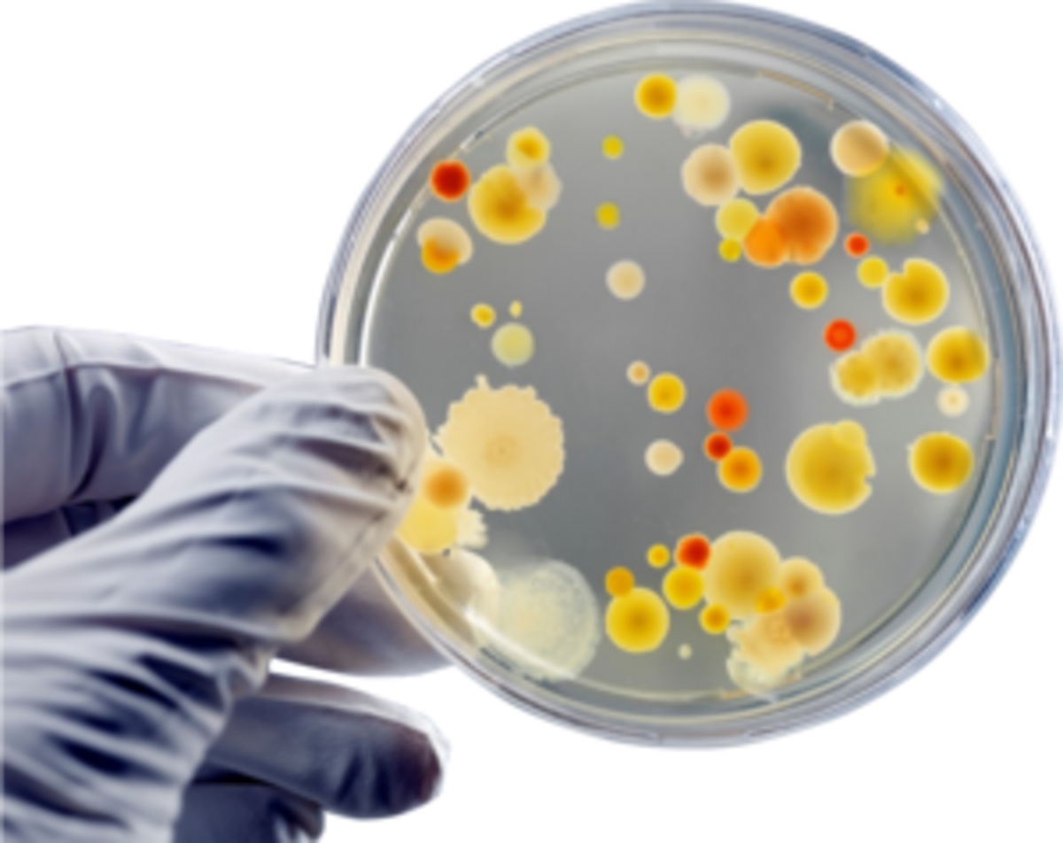 Determination of pH as Quality Control Test in Culture Media