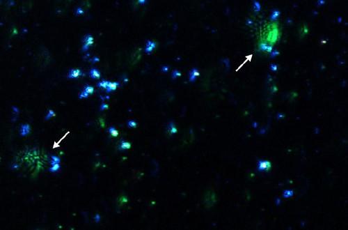 Nanobubble Size and Concentration Analysis with Multi-laser NTA