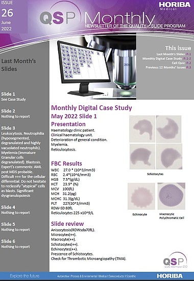 HORIBA_Medical_QSP_Newsletter__26_-_Schistocytes_-_web HORIBA_Medical_QSP_Newsletter__26_-_Schistocytes_-_web