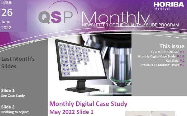HORIBA_Medical_QSP_Newsletter__26_-_Schistocytes_-_web HORIBA_Medical_QSP_Newsletter__26_-_Schistocytes_-_web