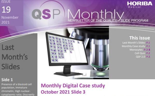 HORIBA Medical QSP Newsletter #19 - Leukocytosis HORIBA Medical QSP Newsletter #19 - Leukocytosis