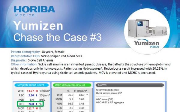 HORIBA Medical_Chase the Case #3 - Sickle Cell Anemia HORIBA Medical_Chase the Case #3 - Sickle Cell Anemia