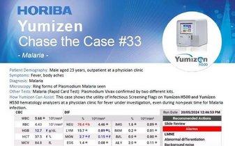 HORIBA Chase the Case #33 - Malaria