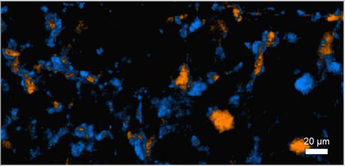 Polymorphisms characterization: when Raman microscopy supports the pharmaceutical industry