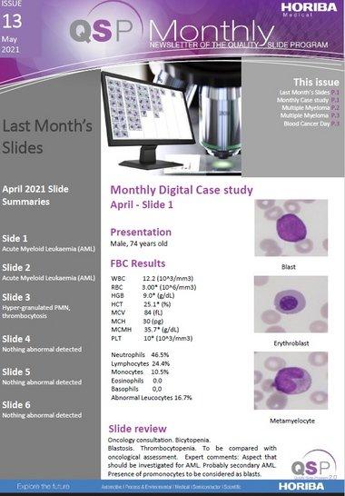 QSP Newsletter_Issue 13_May 2021_Banner_big_HORIBA Medical QSP Newsletter_Issue 13_May 2021_Banner_big_HORIBA Medical