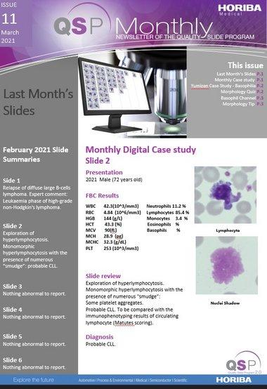QSP Newsletter_Issue 11_March 2021_HORIBA Medical QSP Newsletter_Issue 11_March 2021_HORIBA Medical