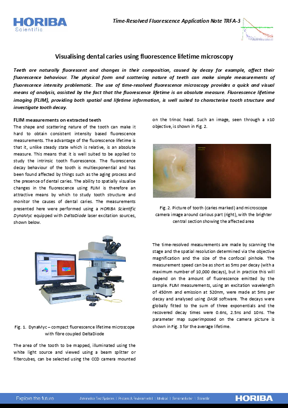 Visualizing dental caries using fluorescence lifetime microscopy thumbnail