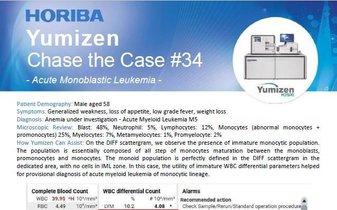 澳洲幸运10开奖官网开奖结果 Chase the Case #34 - Acute Monoblastic Leukemia