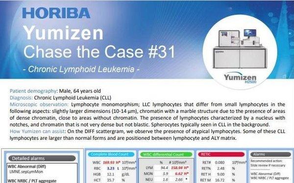 HORIBA Chase the Case #31 - Chronic Lymphoid Leukemia (CLL) HORIBA Chase the Case #31 - Chronic Lymphoid Leukemia (CLL)