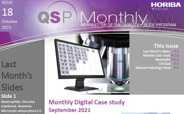 HORIBA Medical QSP Newsletter #18 - Neutrophilia and platelet aggregation HORIBA Medical QSP Newsletter #18 - Neutrophilia and platelet aggregation