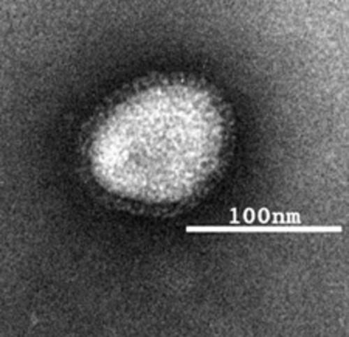 Viruses and Virus-Like Particles