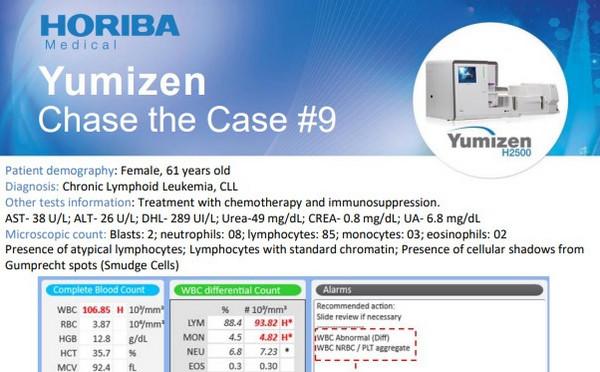 HORIBA Medical Chase the Case #9 (EN) - Chronic Lymphoid Leukemia HORIBA Medical Chase the Case #9 (EN) - Chronic Lymphoid Leukemia