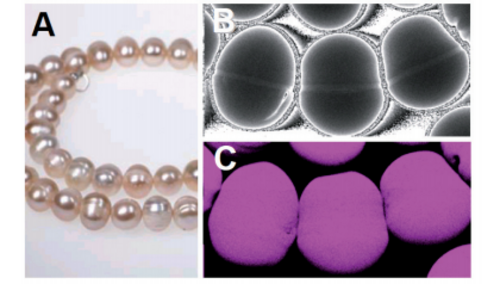 X-ray micro-analysis for pearl characterisation in forensic science