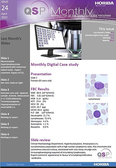 HORIBA Medical QSP Newsletter #24 - Hyperleukocytosis