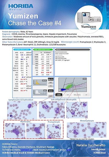 HORIBA Medical Chase the Case #4 (EN) - Sepsis and COVID HORIBA Medical Chase the Case #4 (EN) - Sepsis and COVID