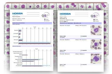 QSP2.0_monthly_hematolog_digital_slides_image_HORIBA_Medical QSP2.0 monthly hematolog digital slides_image_HORIBA Medical