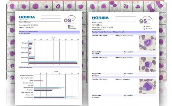 QSP2.0_monthly_hematolog_digital_slides_image_HORIBA_Medical QSP2.0 monthly hematolog digital slides_image_HORIBA Medical