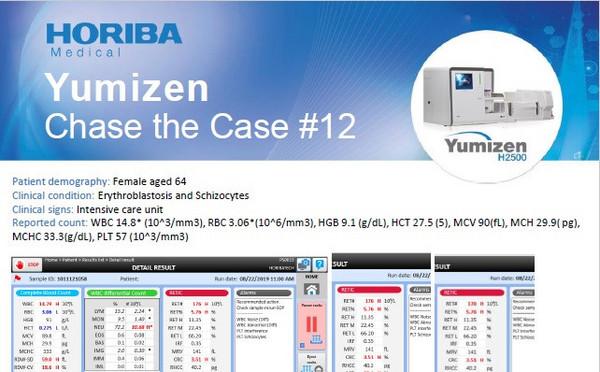 HORIBA Medical Chase the Case #12 (EN) - Erythroblastosis and Schizocytes HORIBA Medical Chase the Case #12 (EN) - Erythroblastosis and Schizocytes