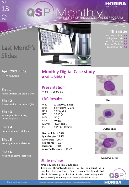 QSP Newsletter_Issue 13_May 2021_HORIBA Medical thumbnail