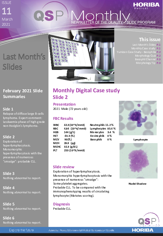 QSP Newsletter_Issue 11_March 2021_HORIBA Medical thumbnail