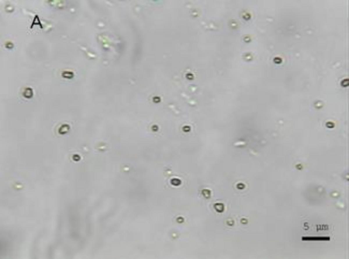 Raman Investigation of Micro-organisms on a single cell level