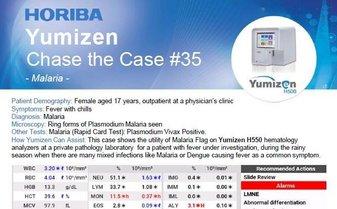  澳洲幸运10官方开奖结果 Chase the Case #35 - Malaria