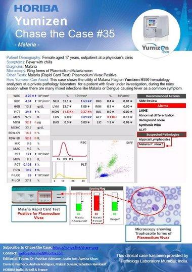 HORIBA Chase the Case #35 - Malaria  HORIBA Chase the Case #35 - Malaria