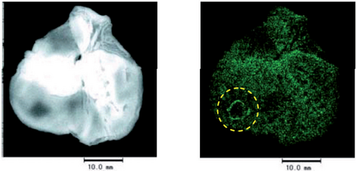 Biological applications of XRF microscopy