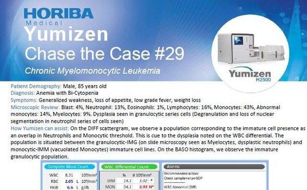 HORIBA Medical Chase the Case #29 - Chronic Myelomonocytic Leukemia HORIBA Medical Chase the Case #29 - Chronic Myelomonocytic Leukemia