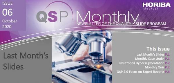 QSP Newsletter_October 2020_HORIBA Medical_EN
