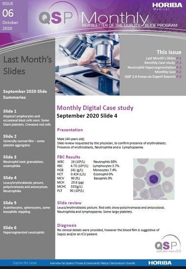 QSP Newsletter_October 2020_HORIBA Medical_EN
