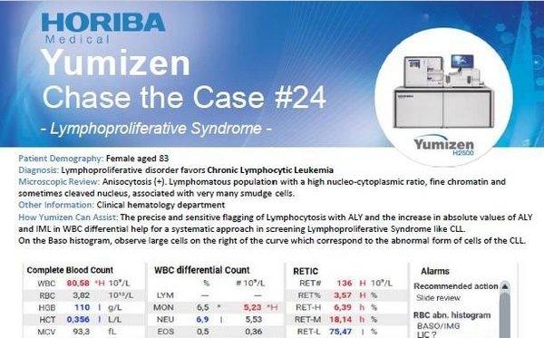 HORIBA Medical Chase the Case #24 - Lymphoproliferative Syndrome HORIBA Medical Chase the Case #24 - Lymphoproliferative Syndrome