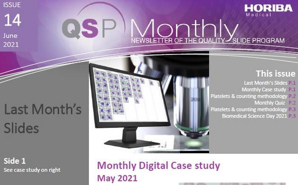 HORIBA Medical QSP Newsletter #14 - Platelets and counting methodology HORIBA Medical QSP Newsletter #14 - Platelets and counting methodology