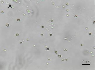 Raman Investigation of Micro-organisms on a single cell level