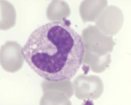 Quiz cell image Heme Insights #3