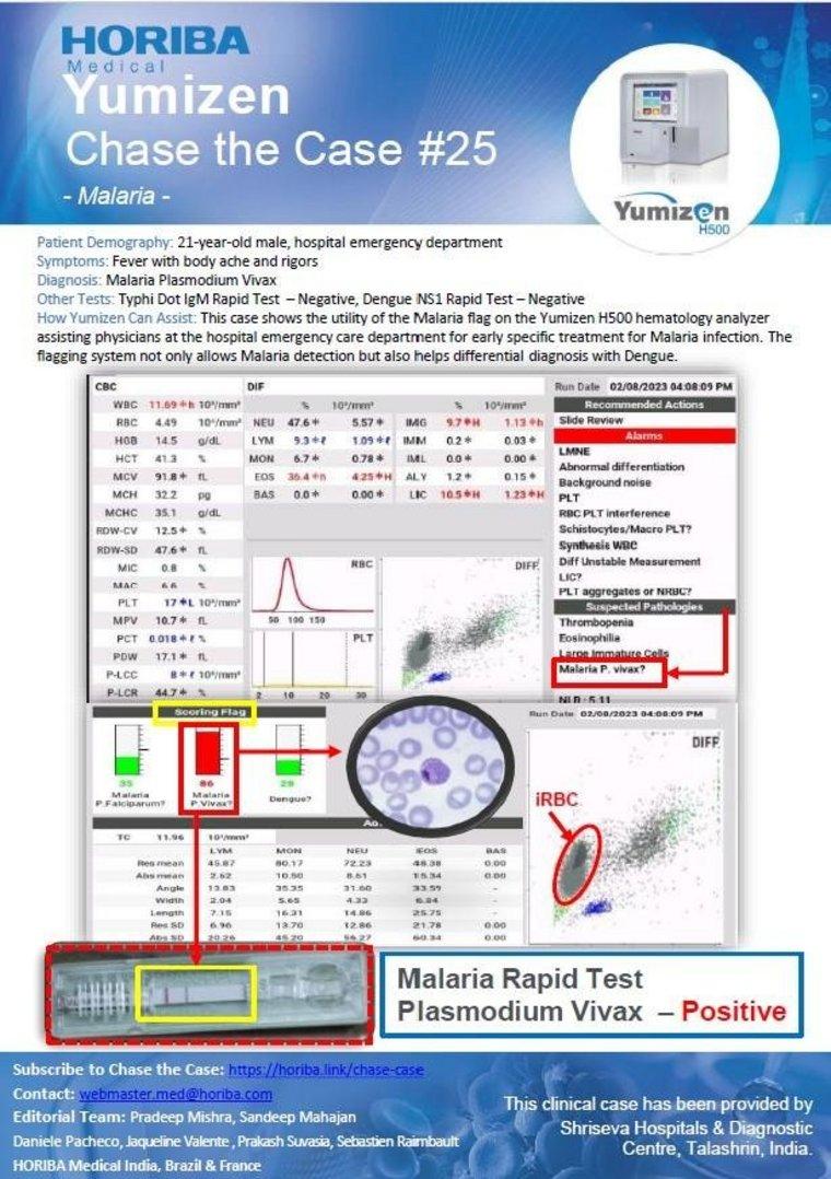 Malaria Yumizen Hematology Clinical Cases "Chase the Case" 25 HORIBA