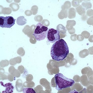 Promyelocyte
