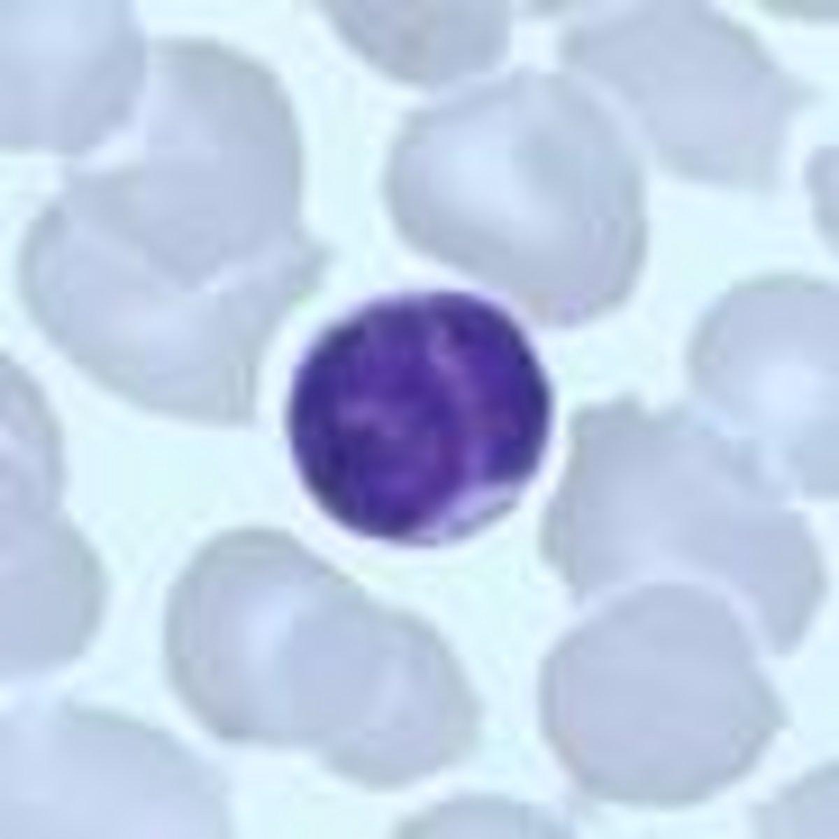 matutes-score-blood-cell-morphology-newsletter-41-horiba-medical