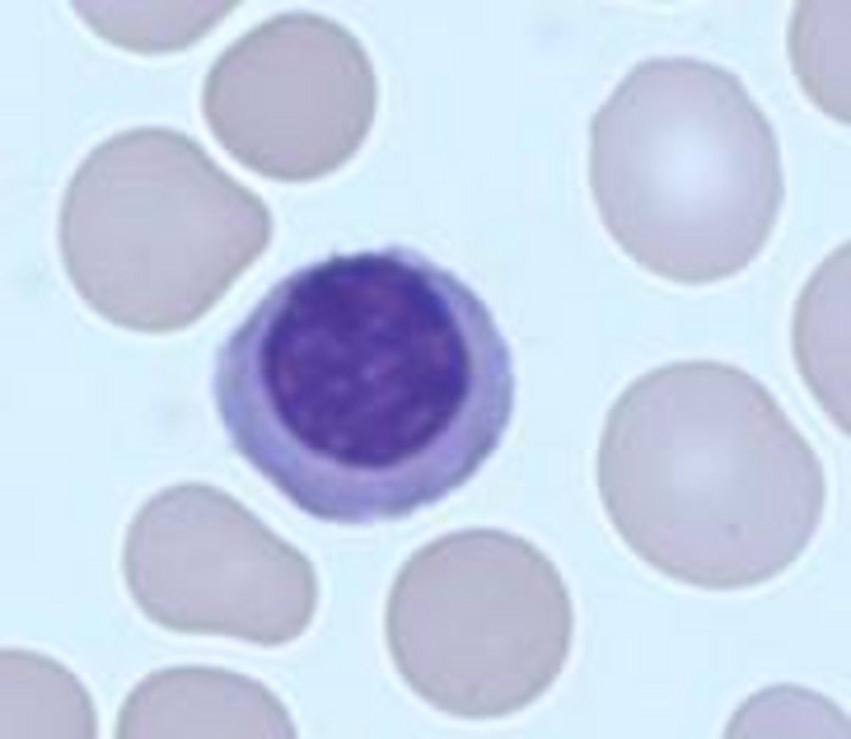 Hemoglobinopathies qsp newsletter 38 horiba medical 
