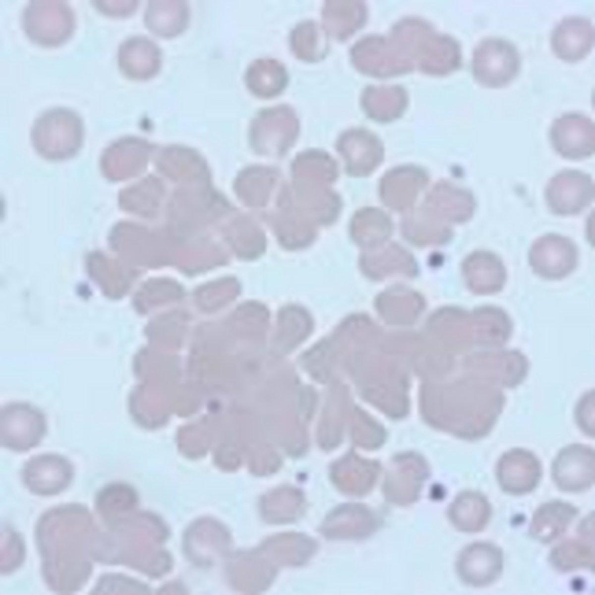 Cabot rings in Blood smear - YouTube