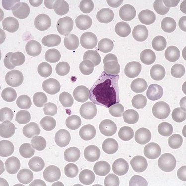 Large_granular_lymphocyte