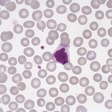 Large_granular_lymphocyte