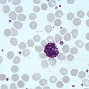 Basophil_polymorphonuclear