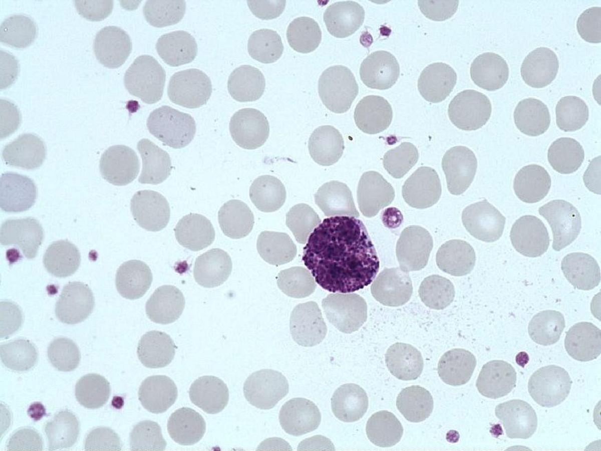Basophil_polymorphonuclear