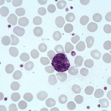 Basophil_polymorphonuclear