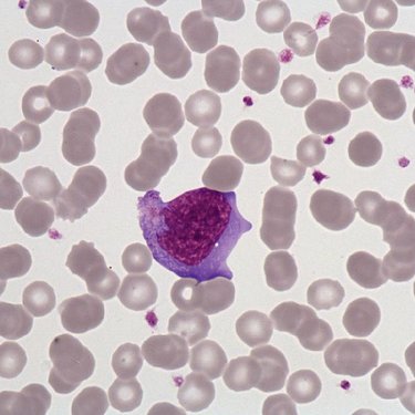 Hyperbasophilic_lymphocyte