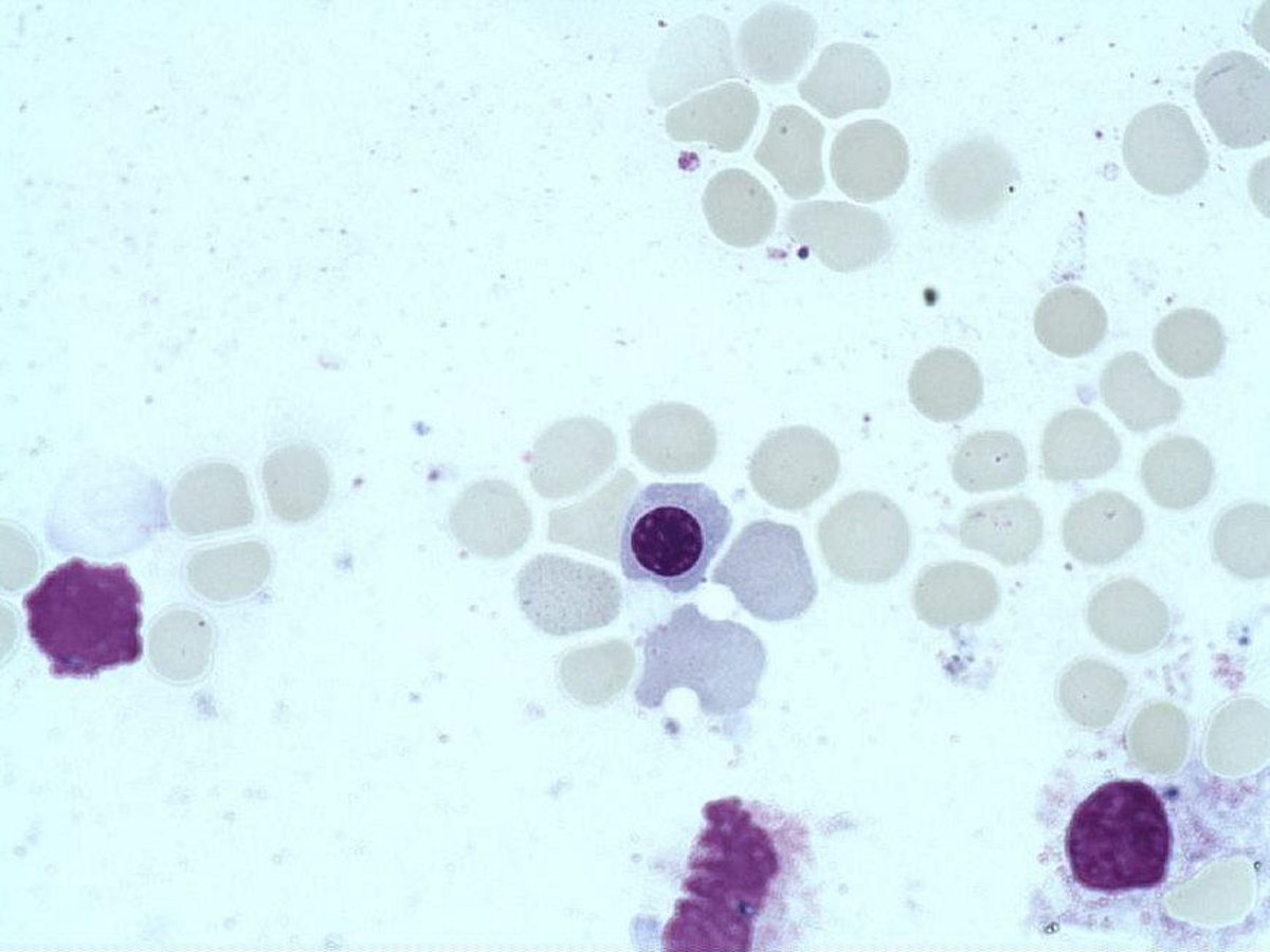 Orthochromatic_erythroblast